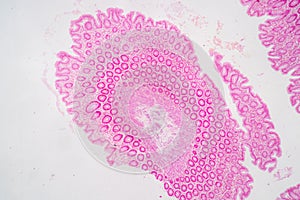 Tissue of Stomach Human, Small intestine Human, Pancreas Human and Large intestine Human under the microscope.