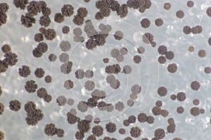 Colony Characteristics of Fungus Rhizopus in petri dish for education.
