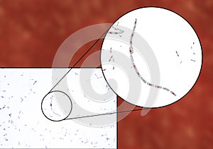 Bacteria Bacillus anthracis