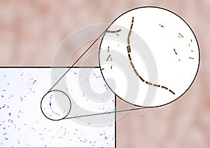 Bacteria Bacillus anthracis