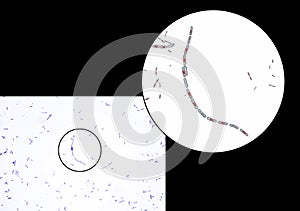 Bacteria Bacillus anthracis