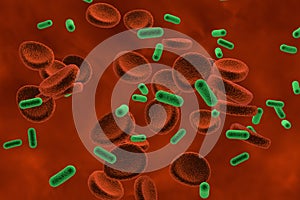Bacteria in blood, bacteriemia