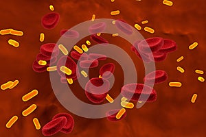 Bacteria in blood, bacteriemia