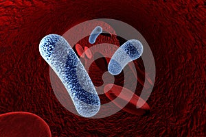 Bacteria in blood, bacteriemia