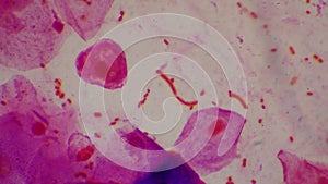 Bacteria cell Gram neagative bacilli with capsule pathogen.Sample sputum in Gram stain method