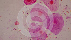 Bacteria cell Gram neagative bacilli with capsule pathogen.Sample sputum in Gram stain method