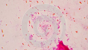 Bacteria cell Gram neagative bacilli with capsule pathogen.Sample sputum in Gram stain method