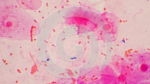 Bacteria cell Gram neagative bacilli with capsule pathogen.Sample sputum in Gram stain method