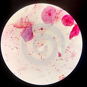 Bacteria cell Gram neagative bacilli with capsule.Sample sputum in Gram stain method