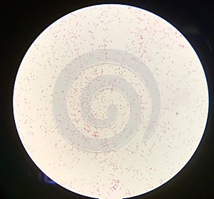 Bacteria cell Gram negative bacilli