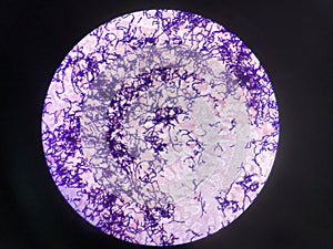 Bacteria cell in gram stain testing.