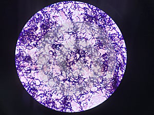 Bacteria cell in gram stain testing.