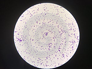 Bacteria cell in gram stain testing.