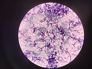 Bacteria cell in gram stain testing.