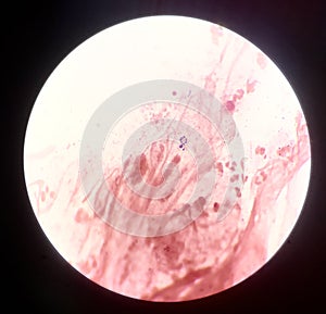Bacteria cell in gram stain testing.