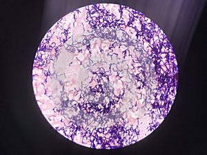 Bacteria cell in gram stain testing.