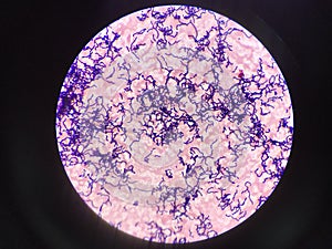 Bacteria cell in gram stain testing.