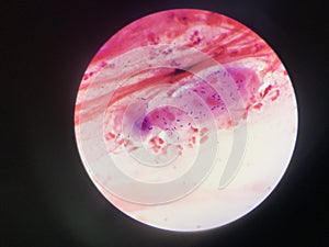 Bacteria cell in gram stain testing.