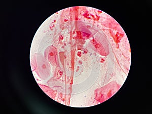 Bacteria cell in sputum sample Gram stain method
