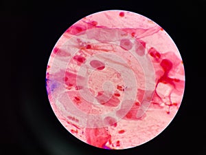 Bacteria cell in sputum sample Gram stain method