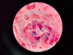 Bacteria cell in sputum sample Gram stain method