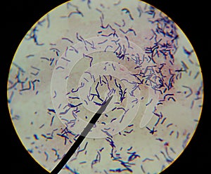 Baktérie bunky zistenie mikroskop 