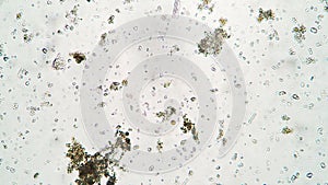 Bacteria and ciliates Colpoda is making it`s way in water from Thailand swamp under microscope