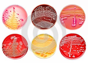 Bacteria colonies