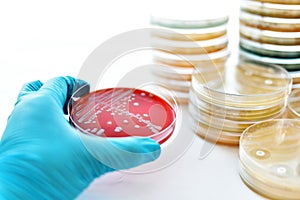 Bacteria colonies