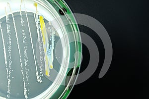Bacteria colonies growth on agar plate petri dish
