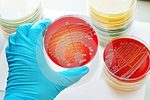 Bacteria culture