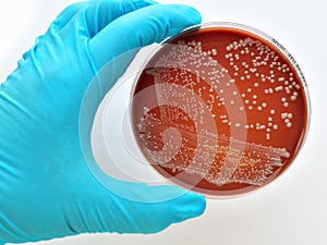 Bacteria culture