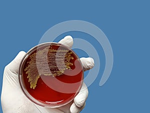 Bacteria culture growth on a petri dish.