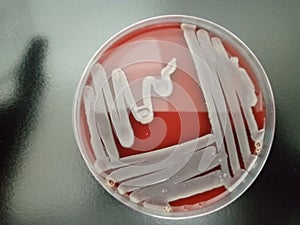 Bacteria on a Culture medium