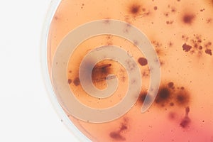 Bacteria culture in petri dish