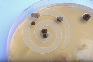 bacteria and fungi growth on culture media in plastic plates