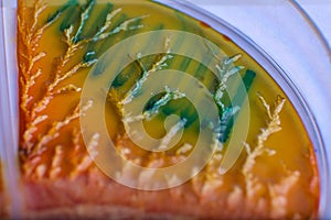 bacteria and fungi growth on culture media in plastic plates