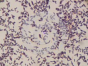 Bacteria gram negative