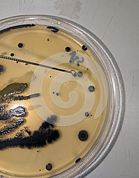 Bacteria Growing on Baird Parker Agar