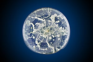 Bacteria growing in a petri dish