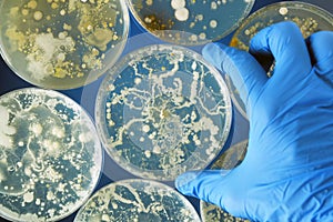 Bacteria growing in a petri dishes