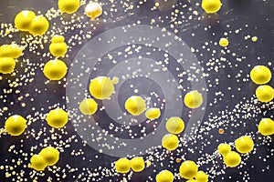 Bacteria grown from skin smear, colonies of Micrococcus luteus and Staphylococcus epidermidis