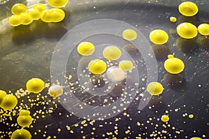 Bacteria grown from skin smear, colonies of Micrococcus luteus and Staphylococcus epidermidis