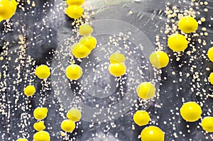Bacteria grown from skin smear, colonies of Micrococcus luteus and Staphylococcus epidermidis