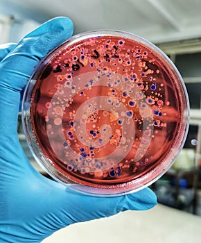 Bacteria Growth on Eosin Methylene Blue (EMB) Agar Plate photo
