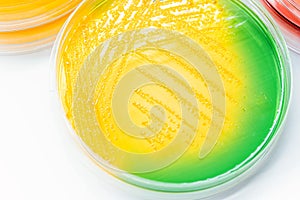 Bacteria growth on TCBS Agar (Thiosulfate Citrate Bile Salts Sucrose Agar)