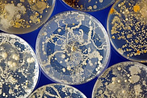 Bacteria in a petri dishes