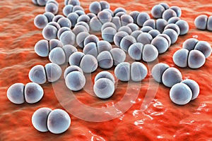 Bacteria pneumococci, Streptococcus pneumoniae photo