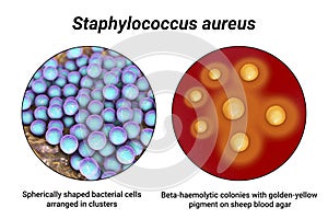 Bacteria Staphylococcus aureus, 3D illustration