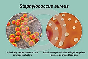 Bacteria Staphylococcus aureus, 3D illustration